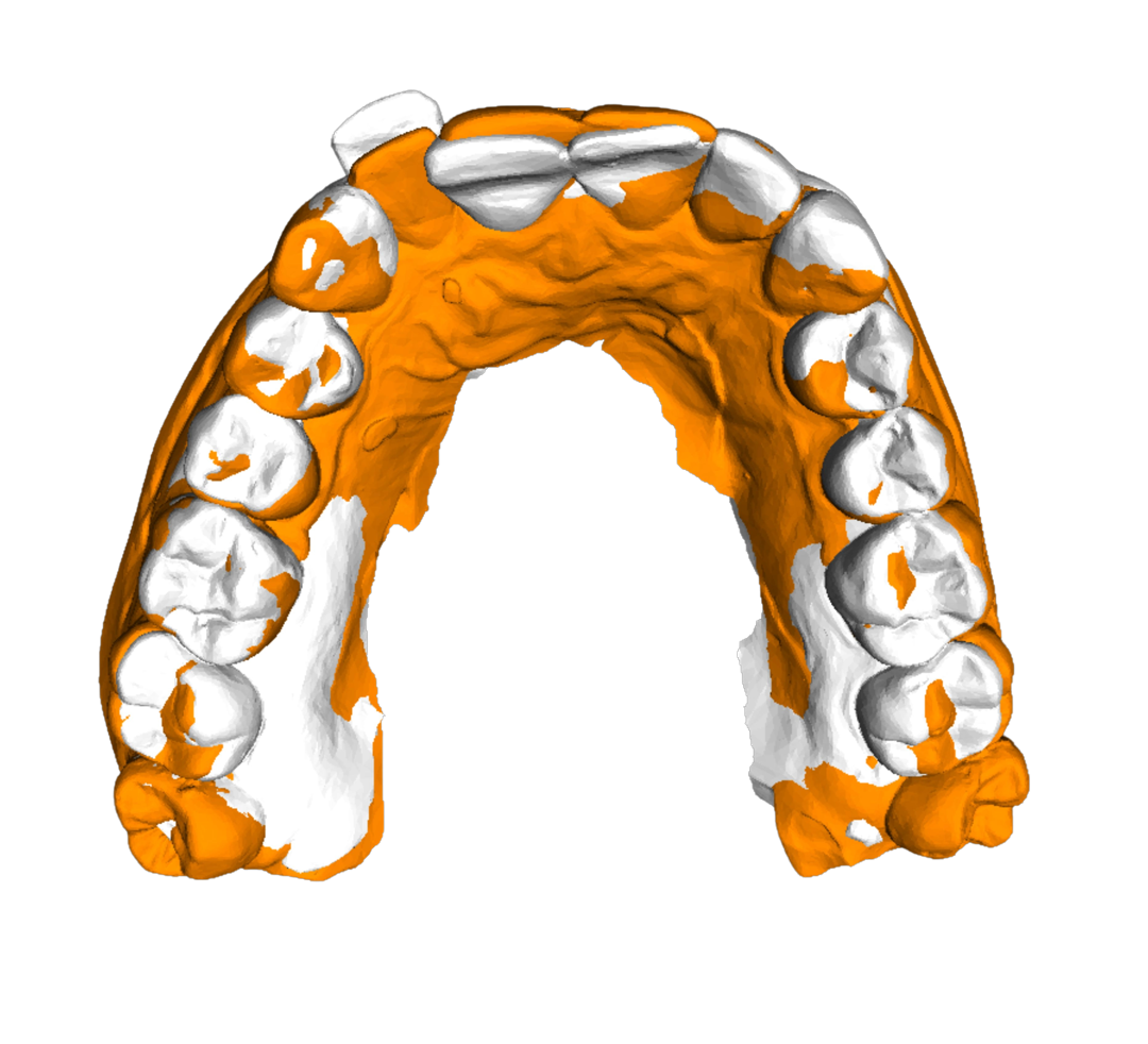 3D model superimposition in 3DDA